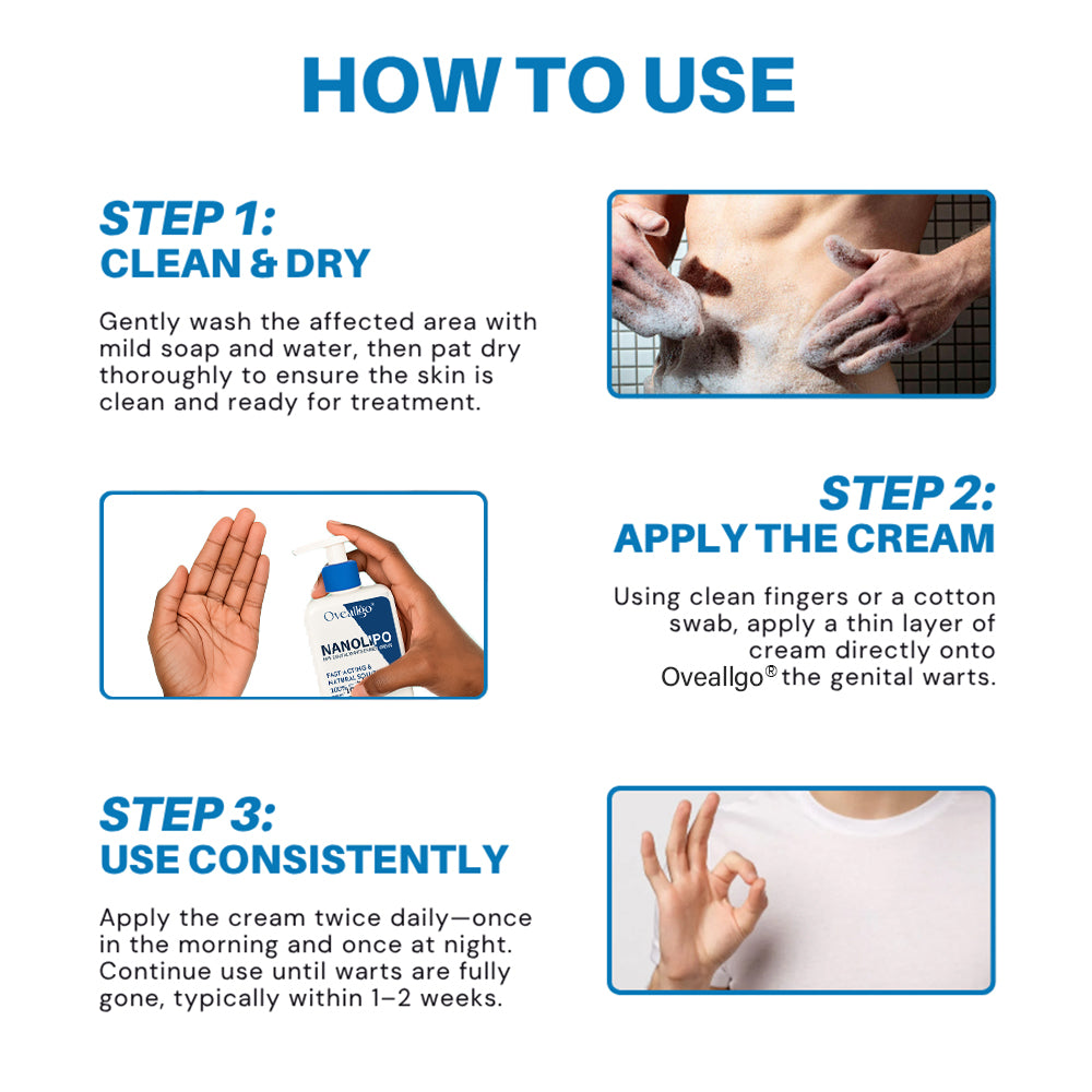 NanoLipo HPV Genital Warts Eraser Cream Prox