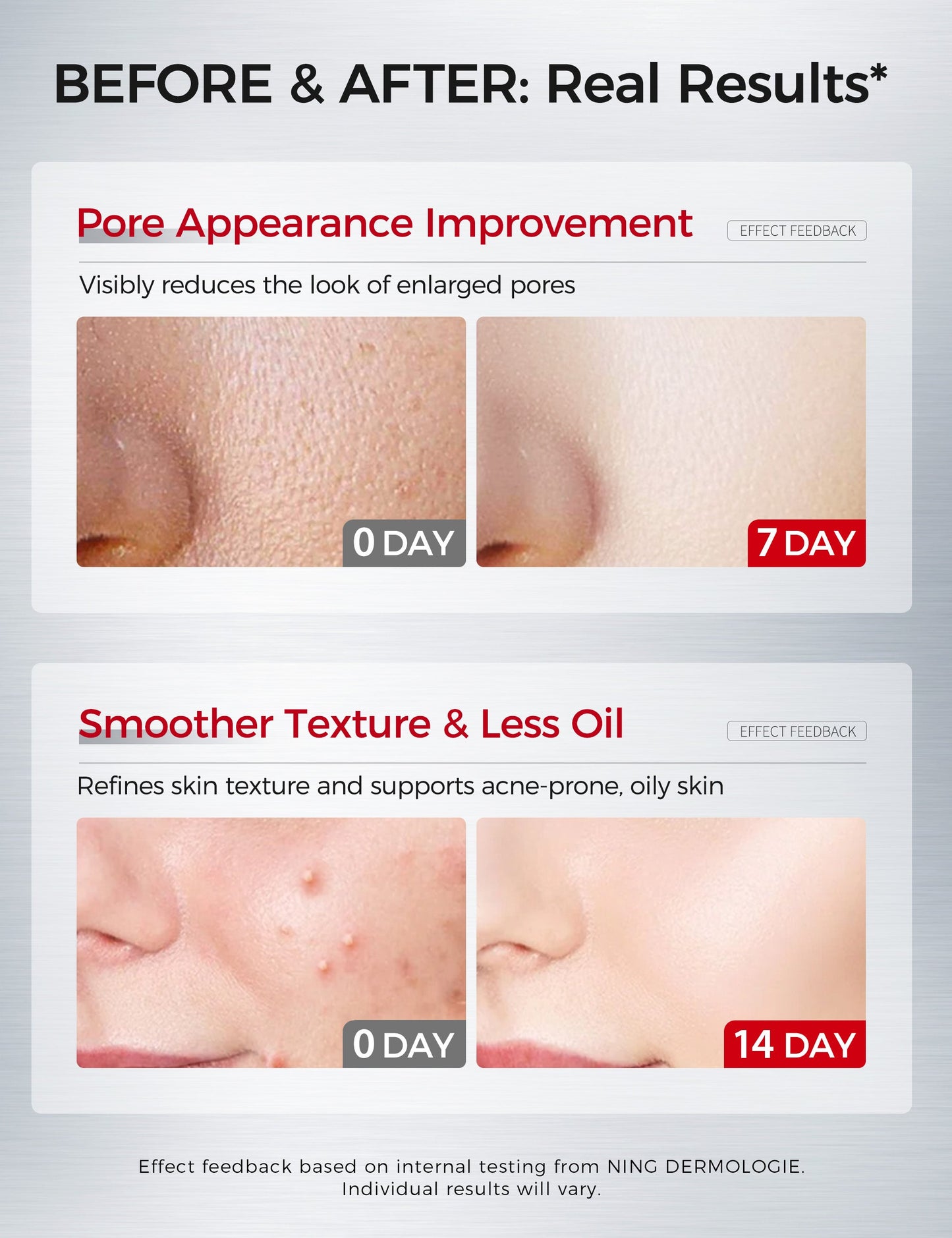 Salicylic Acne Facial Serum 30ml