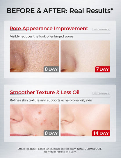 Salicylic Acne Facial Serum 30ml