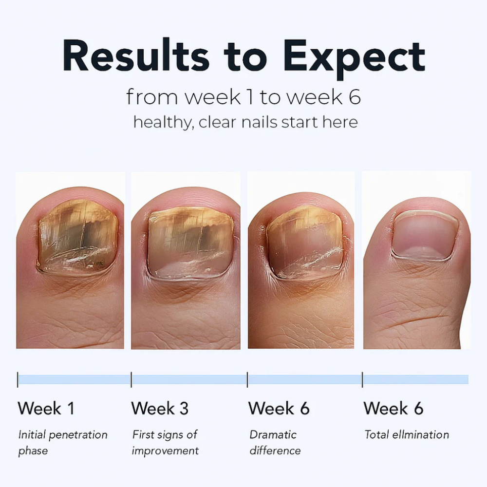 Maanufo Fungal Nail Renewal Patches