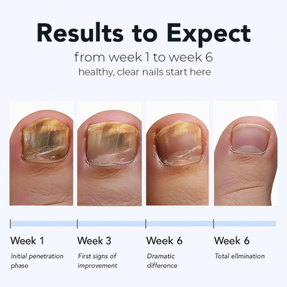 Maanufo Fungal Nail Renewal Patches