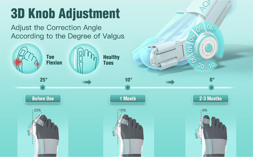 Adjustable Toe Separator & Bunion Corrector