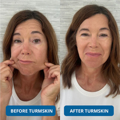3% Hyaluronic Acid Ultra Hydrating Serum by TurmSkin