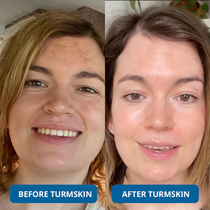 3% Hyaluronic Acid Ultra Hydrating Serum by TurmSkin