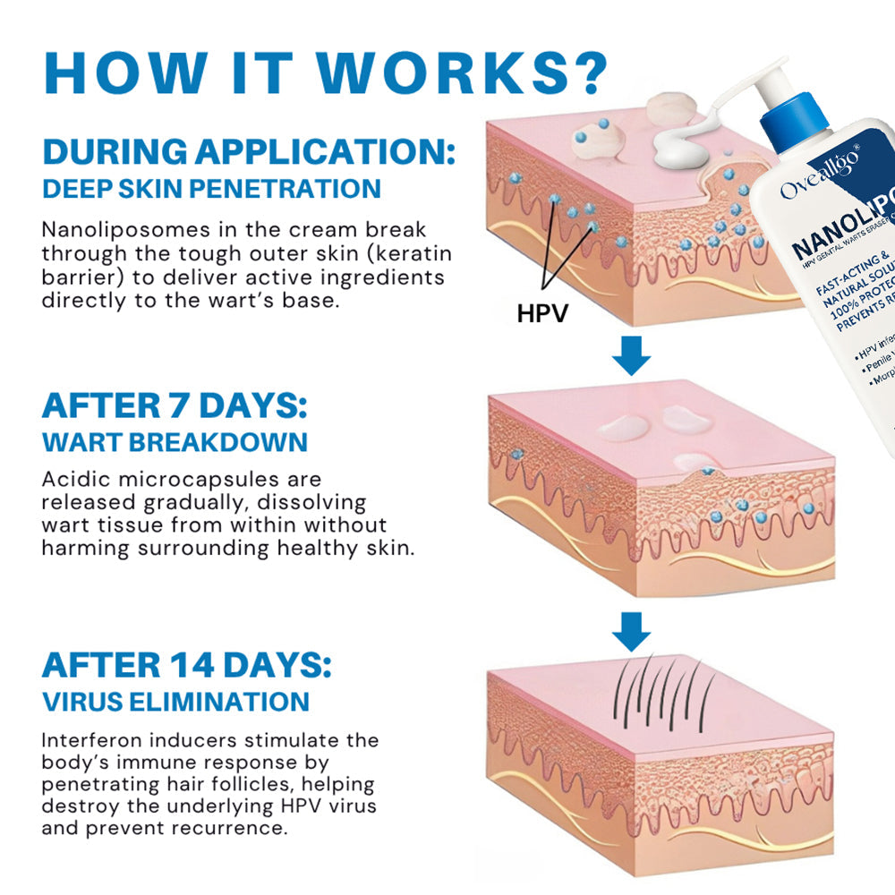 NanoLipo HPV Genital Warts Eraser Cream Prox