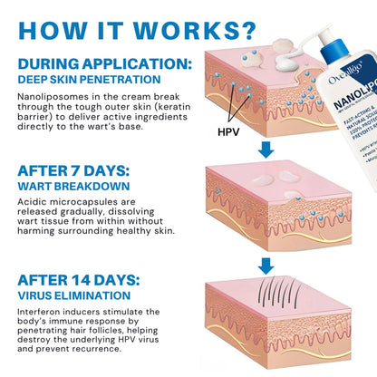 NanoLipo HPV Genital Warts Eraser Cream Prox
