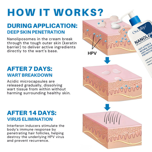 NanoLipo HPV Genital Warts Eraser Cream Prox