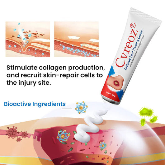 Cvreoz Diabetic Foot Healing Cream
