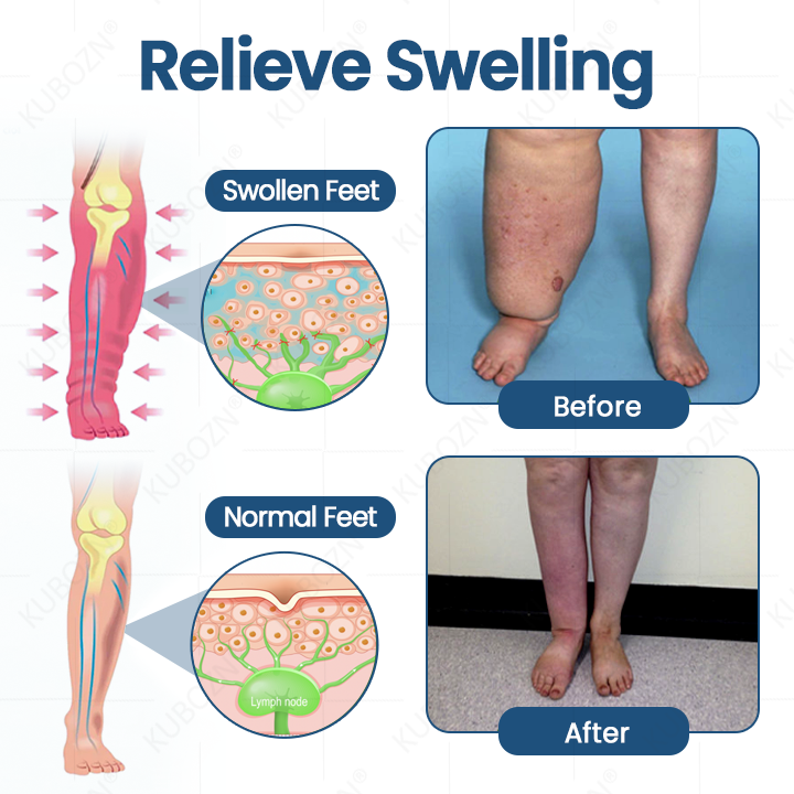 Roll-On Cream for Lymphatic Drainage & Swelling Relief