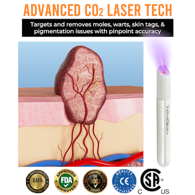 VelvetSkin+ All-in-One Laser Eraser Pen