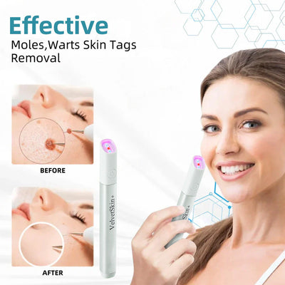 VelvetSkin+ All-in-One Laser Eraser Pen