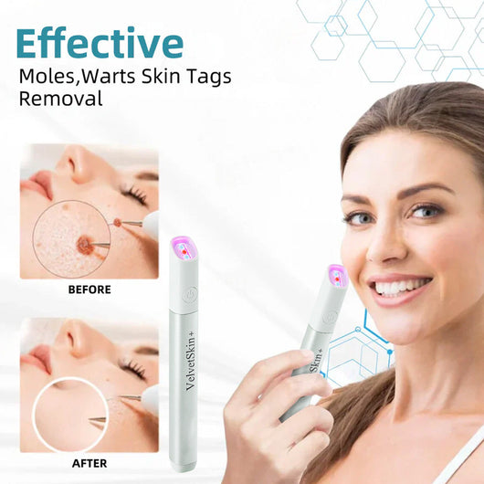 VelvetSkin+ All-in-One Laser Eraser Pen