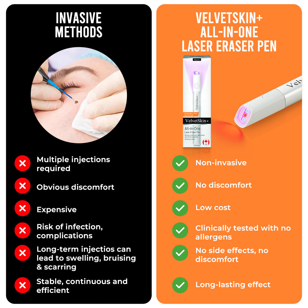 VelvetSkin+ All-in-One Laser Eraser Pen