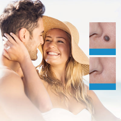 Oupal Tag Kit - Auto Skin Tag Remover