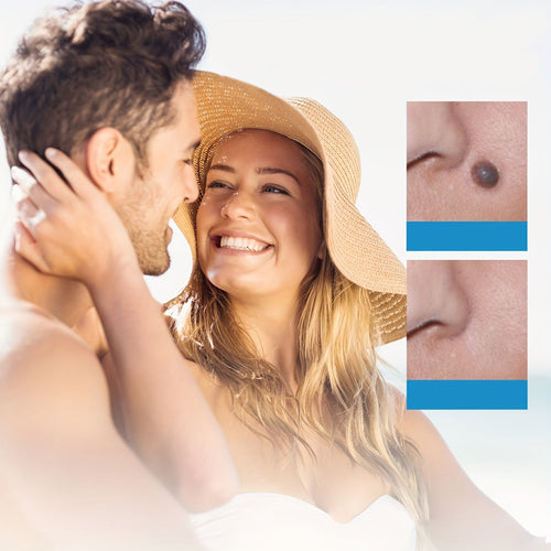 Oupal Tag Kit - Auto Skin Tag Remover