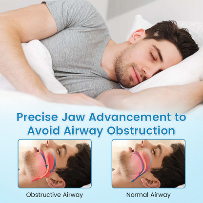 PerfectSleep Solution- Anti-Snoring & Anti-Grinding Teeth Protector