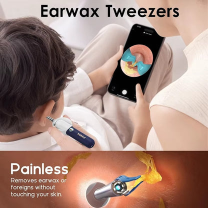 Bebird Earsight Plus Ear Cleaning Camera