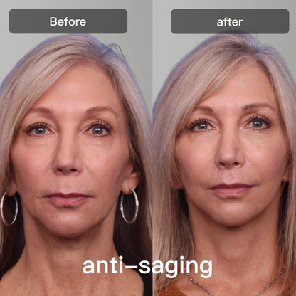 LED Light Therapy Device